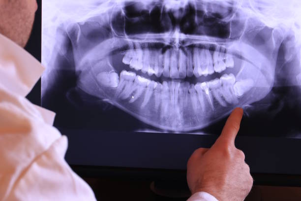 Best Dental Abscess Treatment in Danville, VA